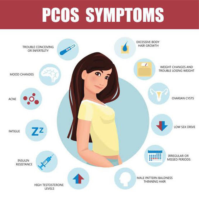 Common symptoms of PCOS