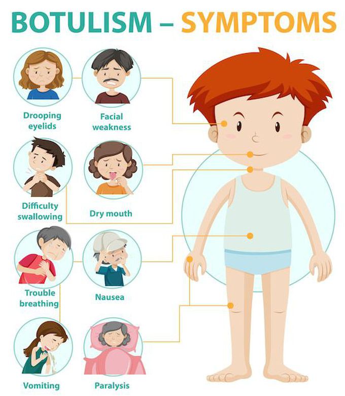 Symptom of Botulism