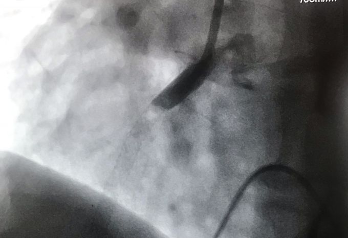 Cardiology