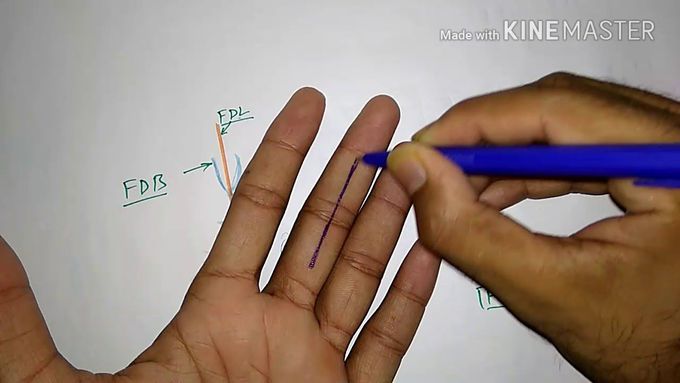 Flexor retinaculum of Leg 👢👢