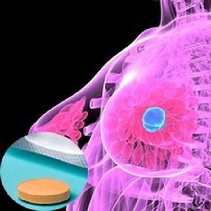 Statins and Breast Cancer