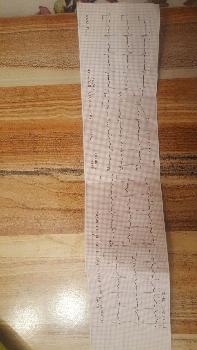 ACUTE CHEST PAIN