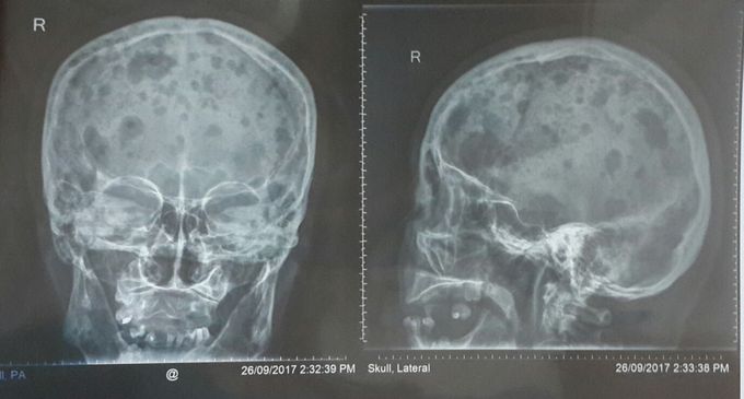 What do you think about this this skull xray????