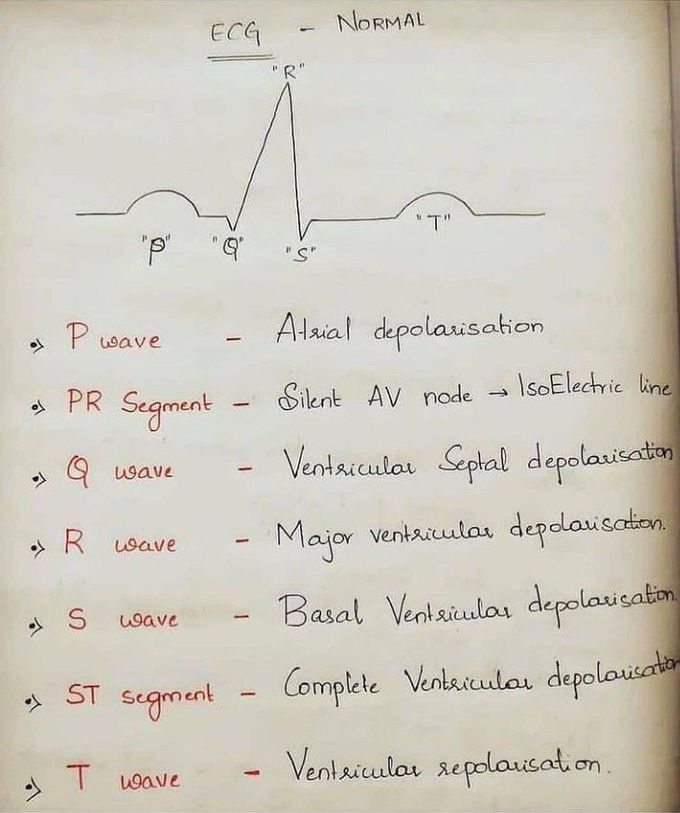 Normal sinus rhythm