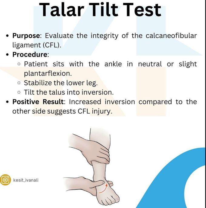 Talar Tilt Test