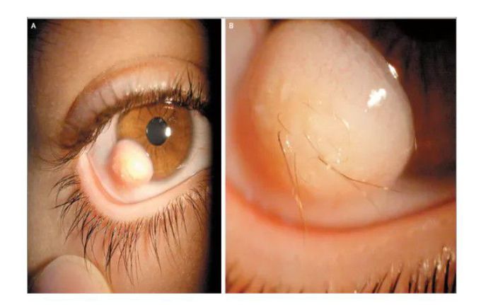 Hairy eyeball!