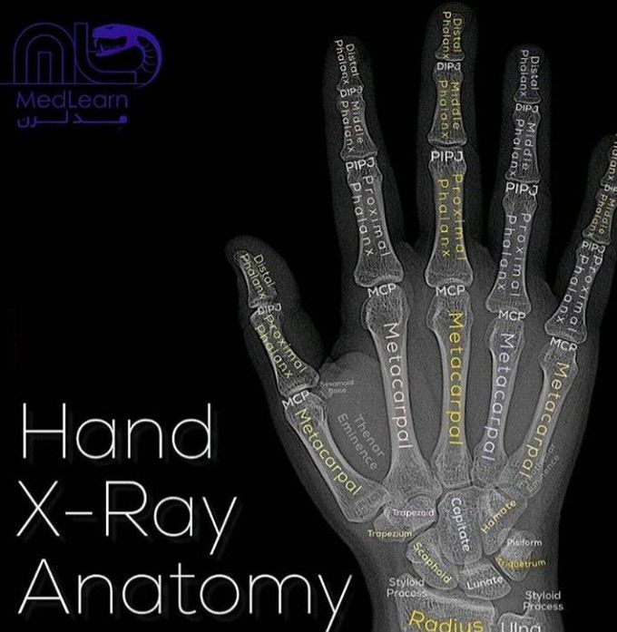 Hand x_ray anatomy