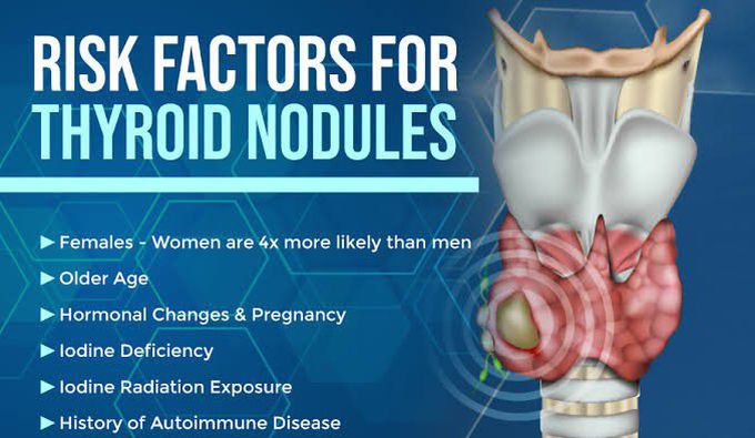 These are the risk factors for Thyroid nodules