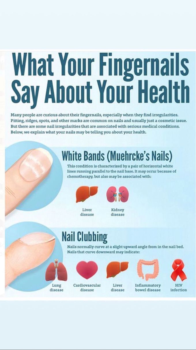 What your fingernails say about your health ✋🏻🧐