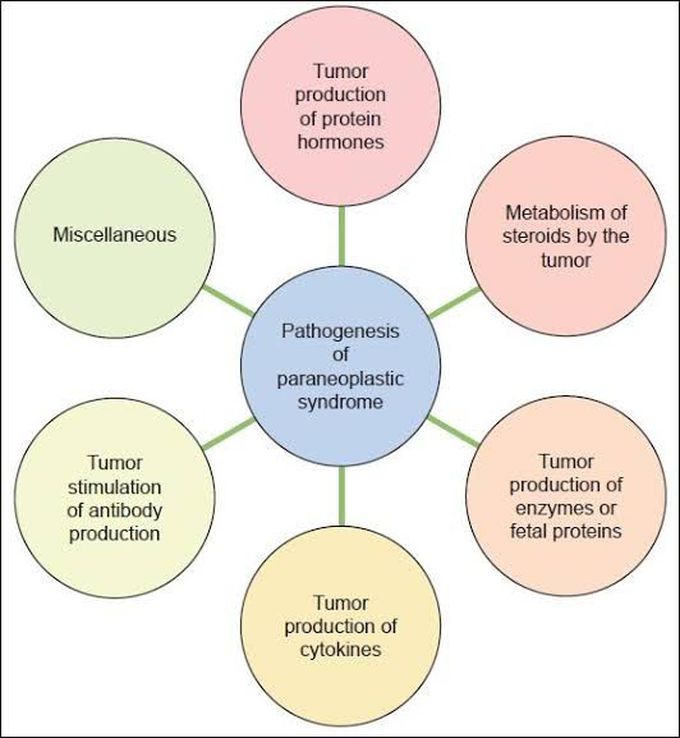 Paraneoplastic Syndrome