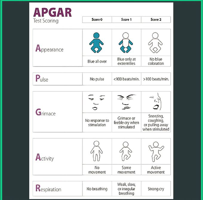 APGAR score 🙌