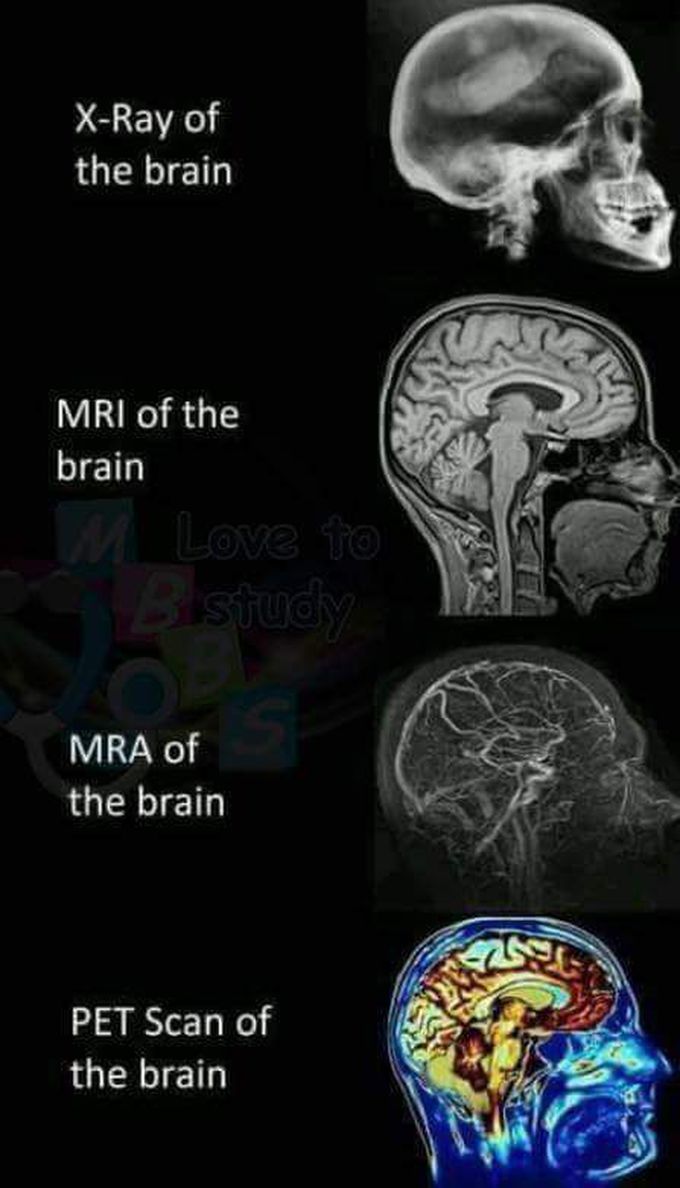 Different scanning techniques for HUMAN BRAIN