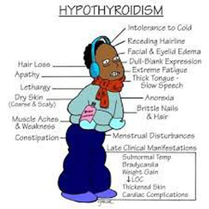 Hypothyroidism