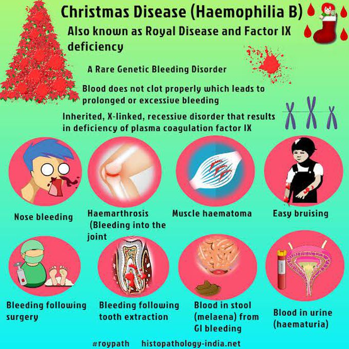 How to treat christmas disease? MEDizzy