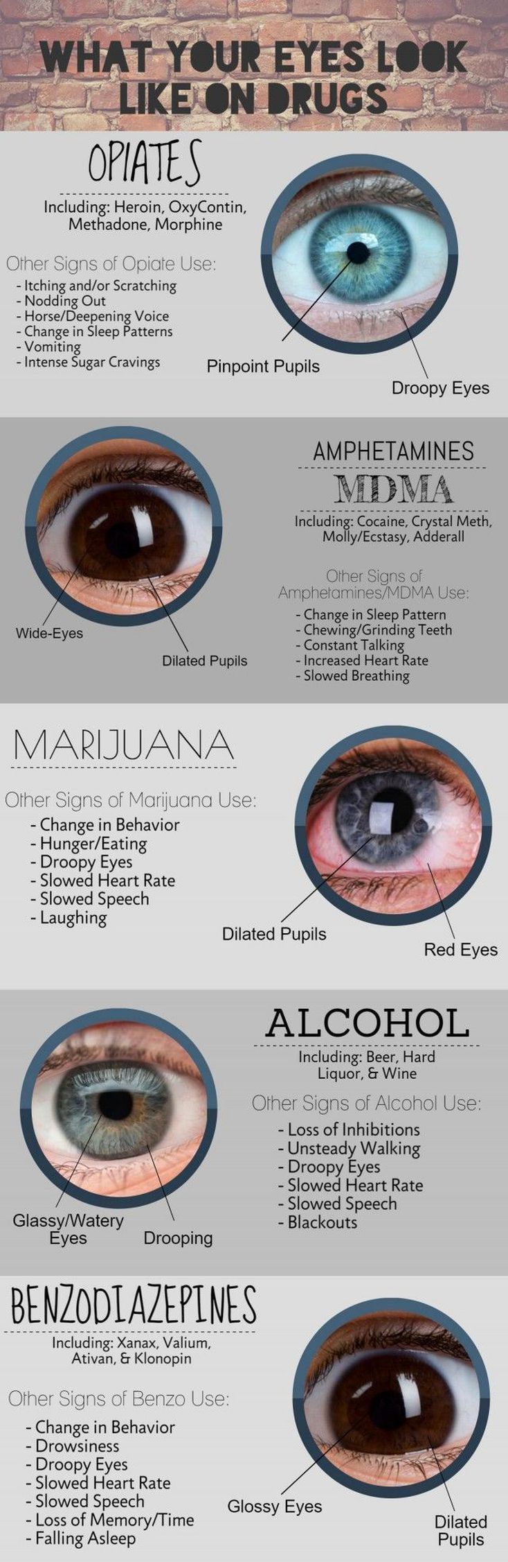 What Your Eyes Look Like On Drugs MEDizzy