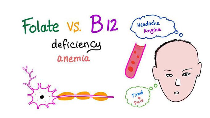 Symptoms of folate deficiency anemia