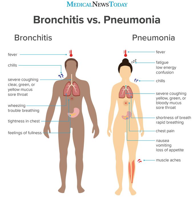 Title: Bronchitis vs. pneumonia: How to tell