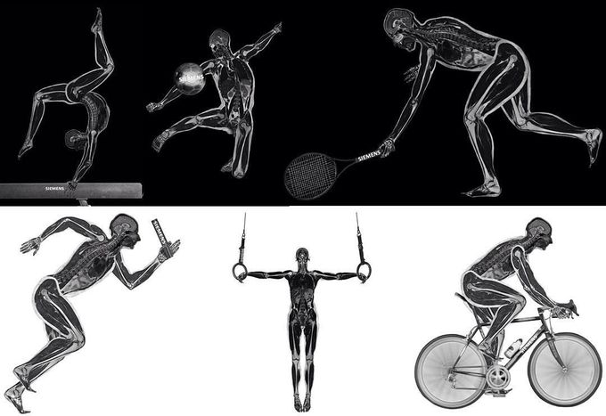 MRI sports ⚽️🎾🚴🏼👌🏼