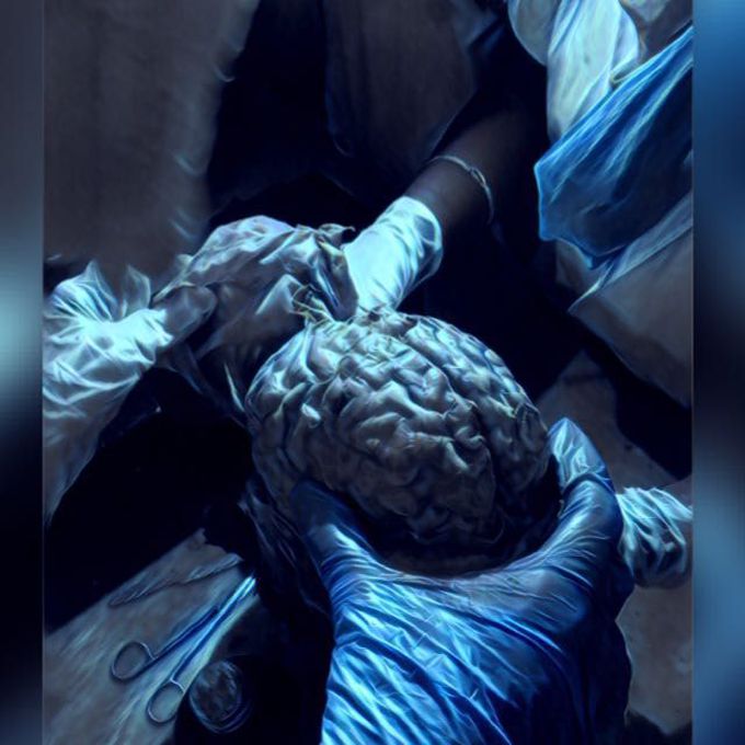 Brain! Do guide me !!