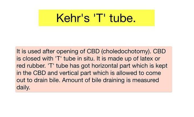 Kehr's 'T ' Tube