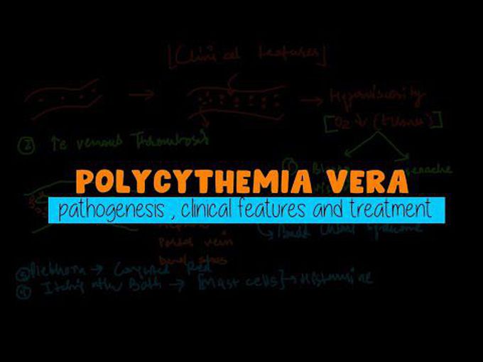 Pathology of Polycythemia Vera