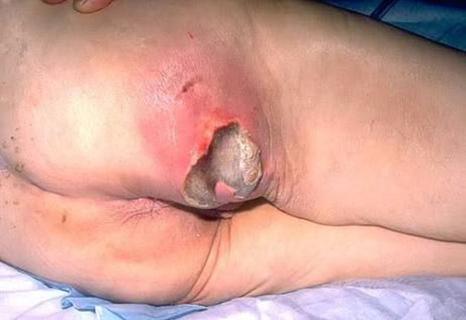 What is diagnosis?