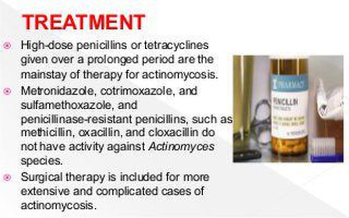 Treatment for Actinimycosis