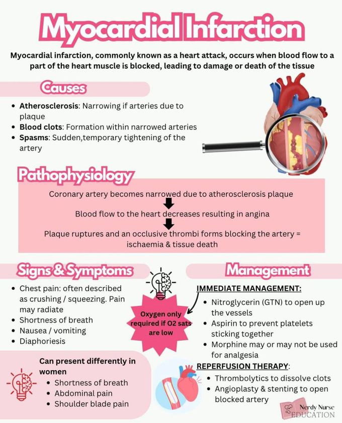 Myocardial Infarction