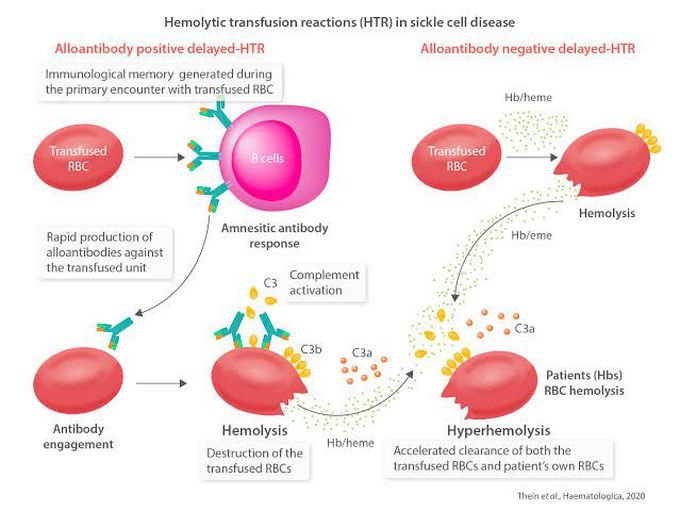 Hemolytic Transfusion Reaction