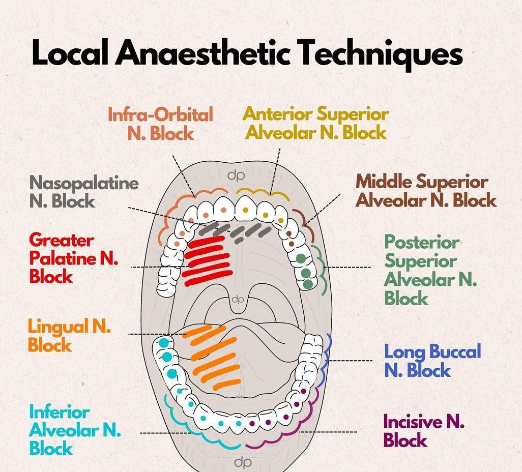 Local Anesthesia Techniques - MEDizzy