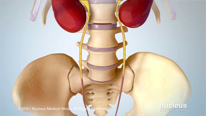 Understanding Stress Urinary Incontinence (SUI)