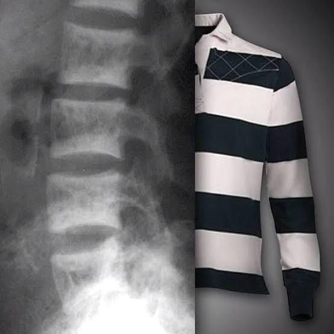 Rugger jersey spine