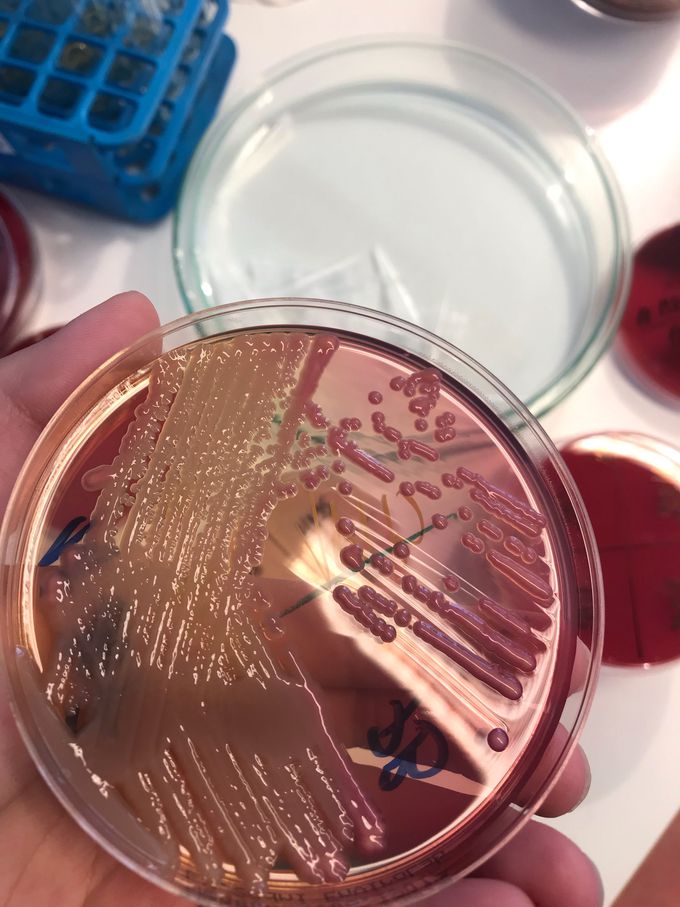 E. coli is causing up to 90% of UTI