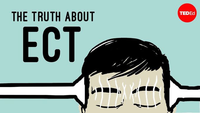 The truth about electroconvulsive therapy (ECT) - Helen M. Farrell