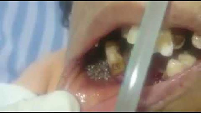 What is diagnosis???