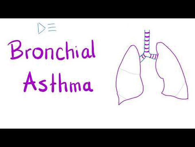 Bronchial Asthma