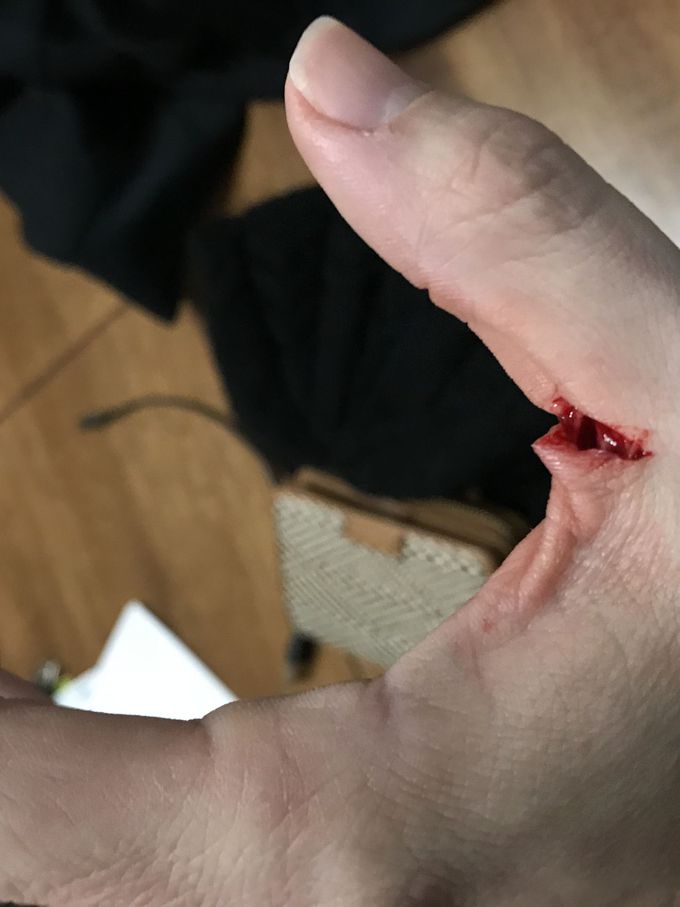 Don’t play with knifes