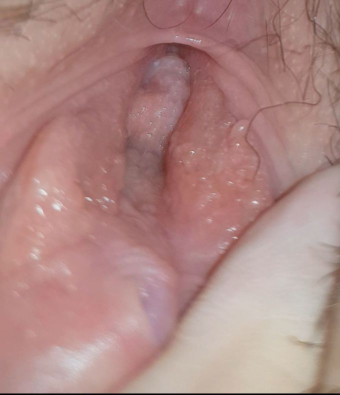 Vulva