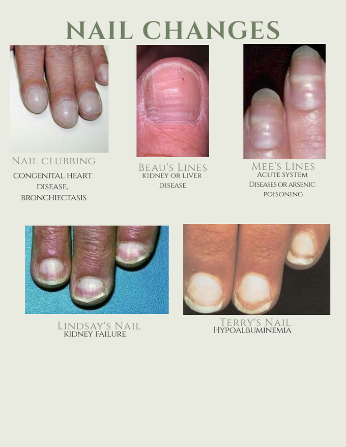 Nails changes