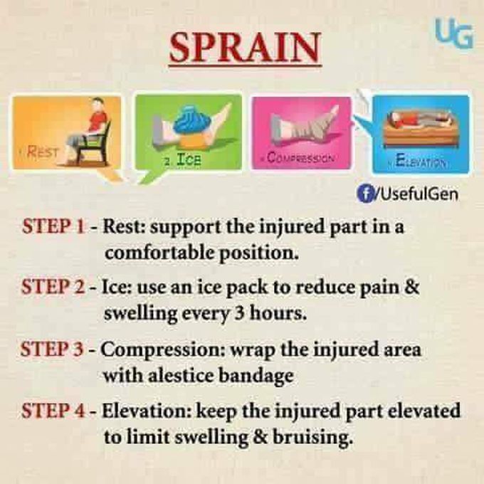 Sprain