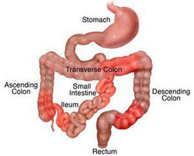 What inflammatory bowel disease does this look like?