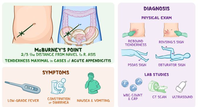 Appendicitis- Diagnosis