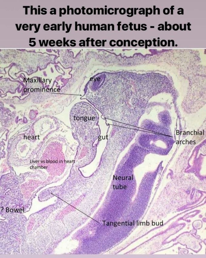 Fetas 5 week after conception