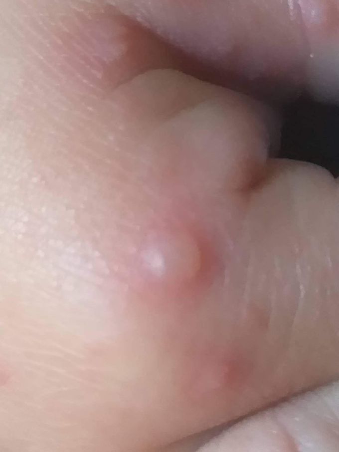 What is your diagnosis?