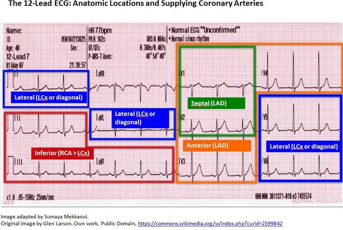 Electrocardiograph