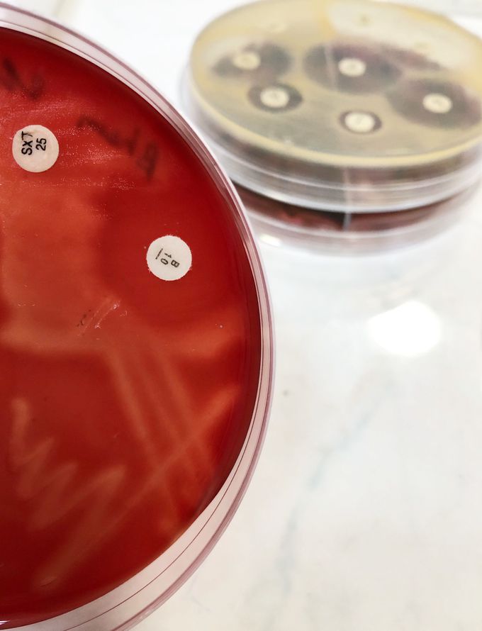 Sample of claws cultivates into blood agar. This is a "gold standart" for detection of Streptococcus pyogenes. We choose the beta-hemolytic colony that appears on Petri dishes and test with Basitrasin and Trimetoprim-Sulphametoxazole antibiotic discs.  If bacteria is sensitive to Basitrasin, but resistant to Trimetoprim-Sulphamoxazole (as in picture), we can say this bacteria is A group beta-hemolytic Streptococcus.  Antibiotic sensitivity test is not developed because Streptococcus pyogenes has not yet detected penicillin resistance.  Treatment is performed empirically.