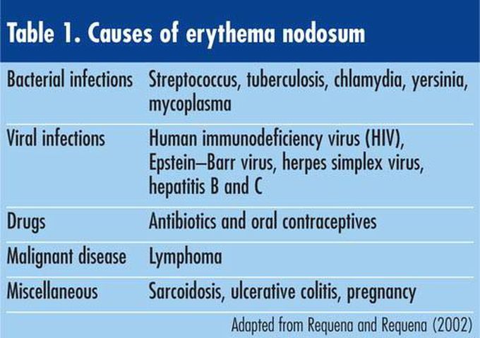 Erythema Nodosum- Causes