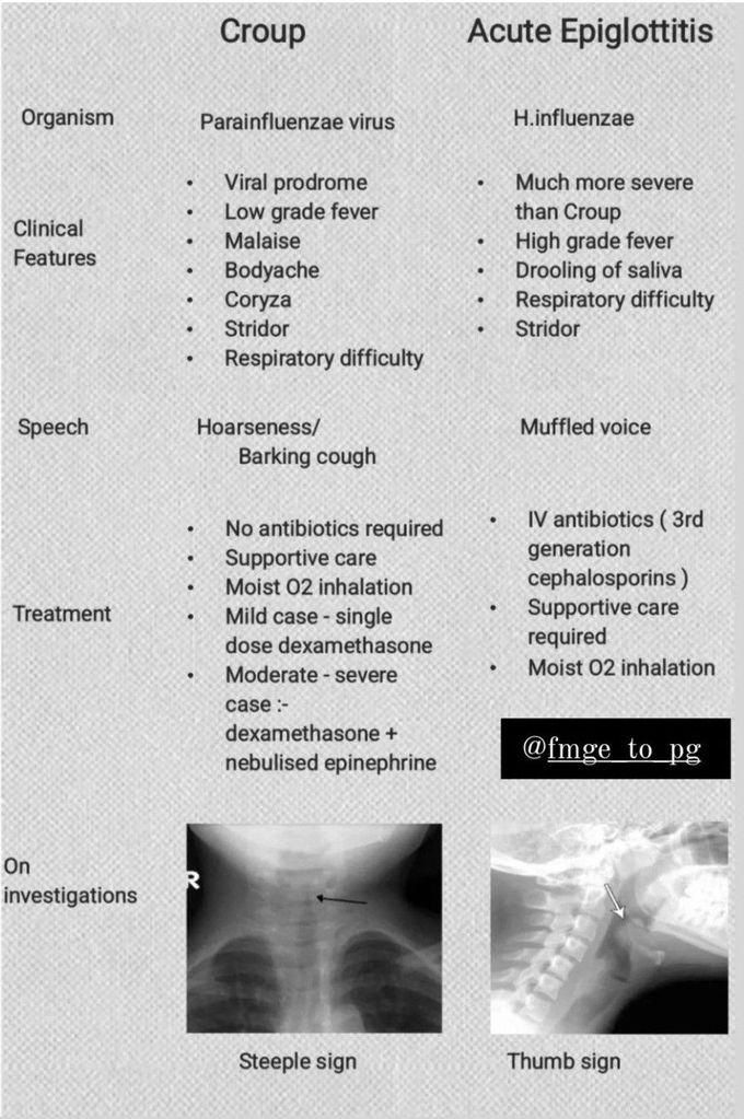 Croup Vs Epiglottitis