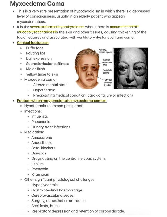 Myxoedema Coma