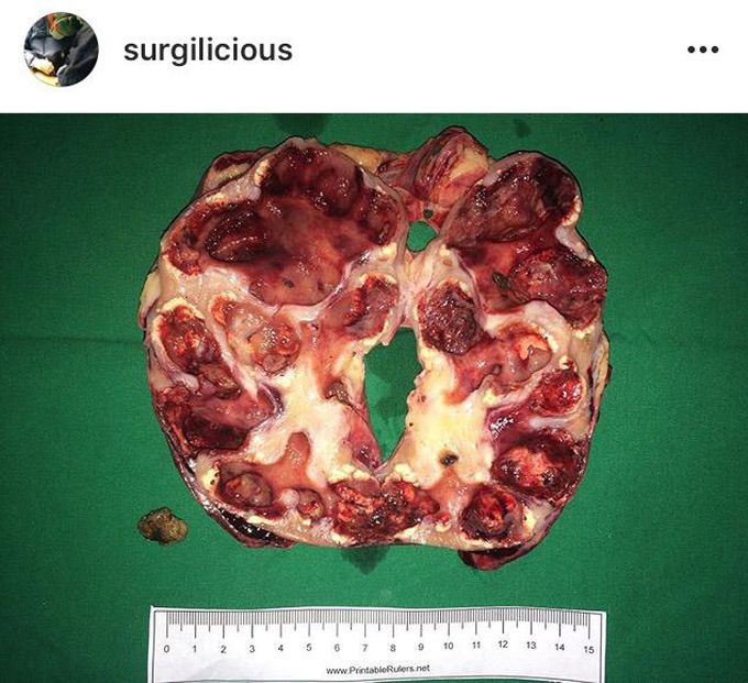 Is this pizza or something ? Lol